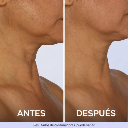 Velunor® Cuello Firme